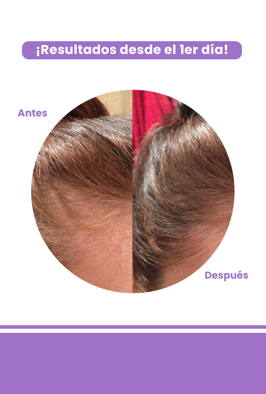 Acondicionador Anticaida & Crecimiento